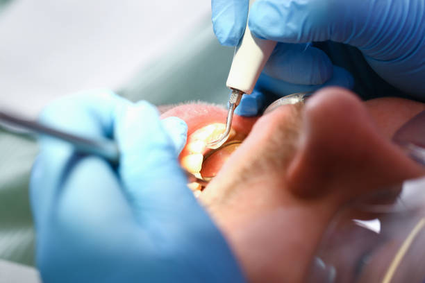 Best Tooth Infection Emergency Dentist  in Oakley, CA