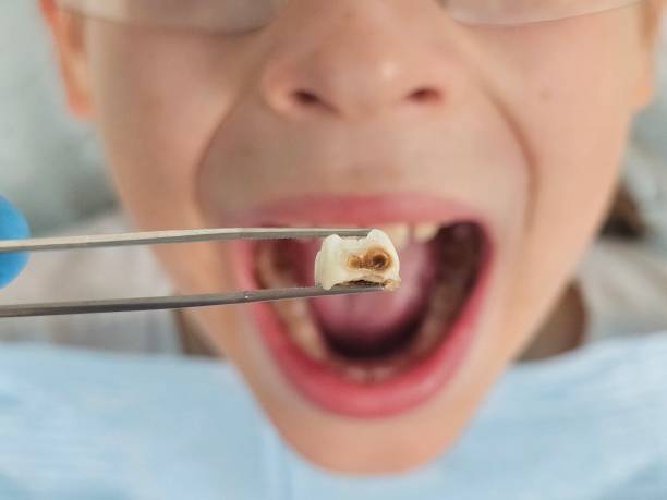 Best Emergency Pediatric Dentist  in Oakley, CA